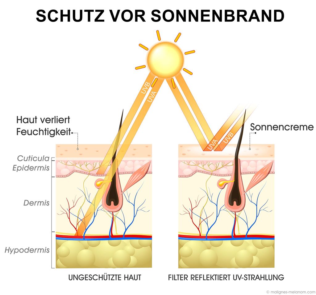 Schutz vor Sonnenbrand